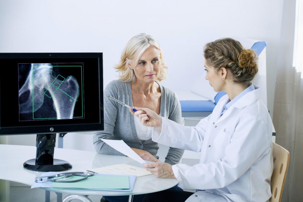 Co to jest osteoporoza? Objawy i leczenie osteoporozy